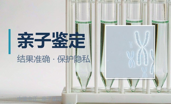 银川DNA亲子鉴定医院在哪,银川医院亲子鉴定准确吗 银川DNA亲子鉴定医院在哪,银川医院亲子鉴定准确吗
