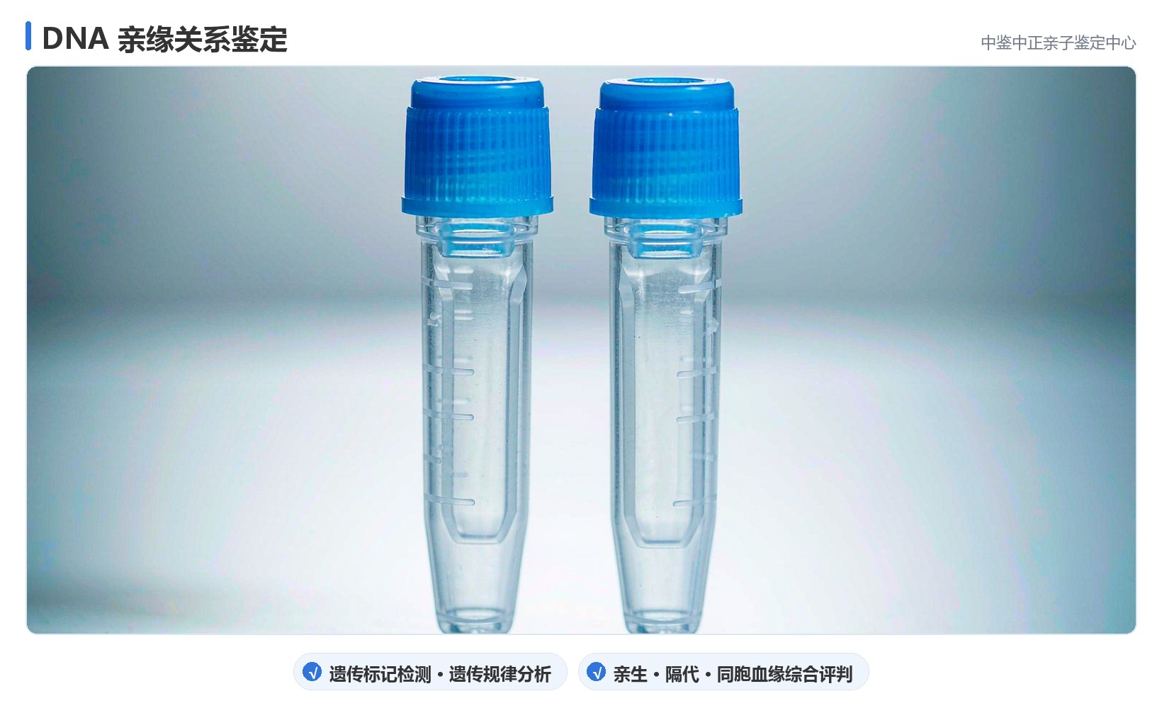 哪些情形需要亲缘鉴定 哪些情形需要亲缘鉴定